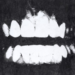 Close up black and white image of a mouth with teeth bared